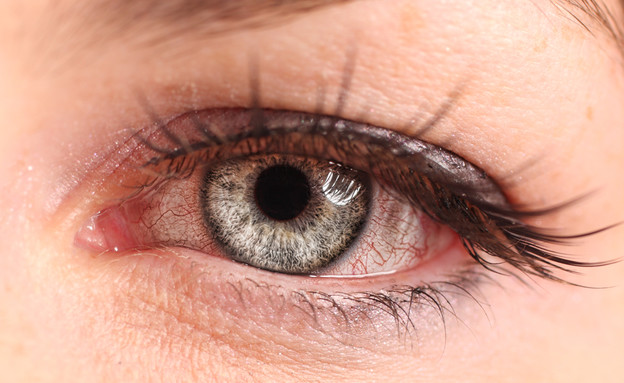 עין אדומה (צילום: Shutterstock/Tom Kuest - Fotograf)