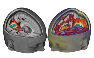 המוח תחת השפעה (מימין) וללא השפעה (משמאל) (צילום: CNN)