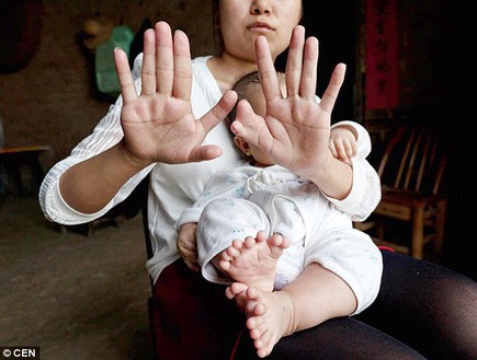 תינוק אצבעות (צילום:  CEN)