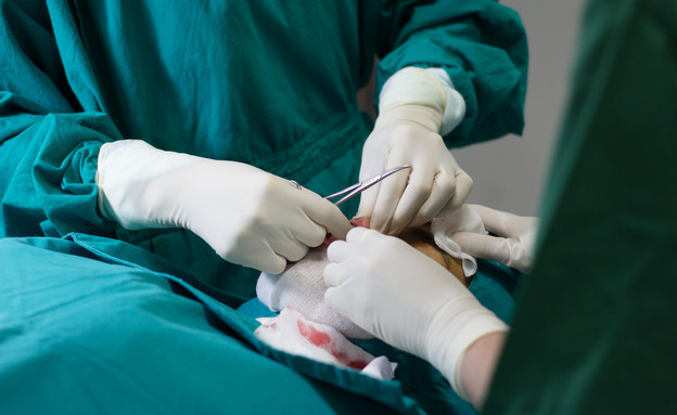 ניתוח (צילום: Shutterstock/Chatchai Anupun)