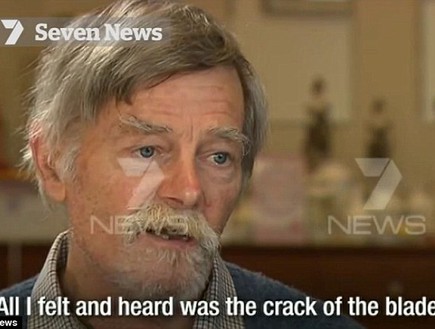 ניסר את פניו