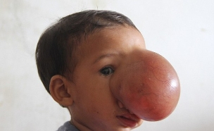 תינוקת גידול על הפנים (צילום: ברקרופט מדיה)