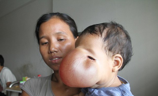 תינוקת גידול על הפנים (צילום: ברקרופט מדיה)