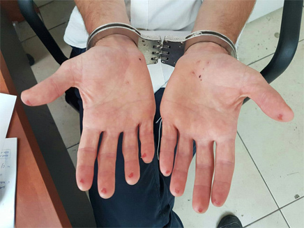חתך את ידיו כדי למנוע זיהוי (צילום: דוברות המשטרה)