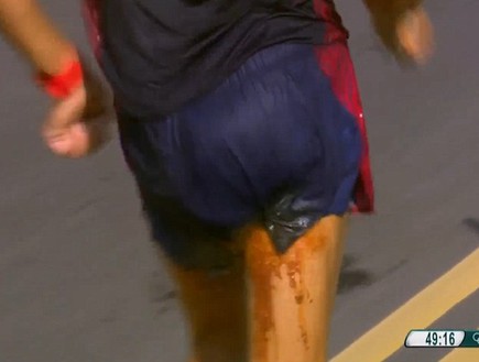 פציעות אולימפיאדה ריו (צילום: BBC)