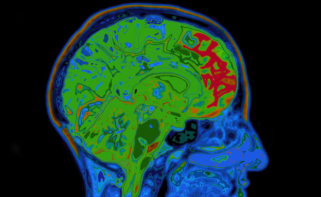 מוח (צילום: SpeedKingz, Shutterstock)