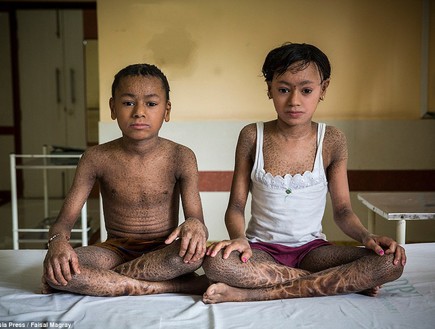 ילדי הנחש (צילום: Cover Asia)