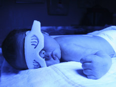 פוטו תרפיה לתינוק - צהבת יילודים (צילום: אימג'בנק / Thinkstock)
