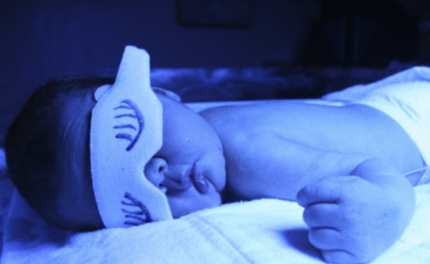 פוטו תרפיה לתינוק - צהבת יילודים (צילום: אימג'בנק / Thinkstock)