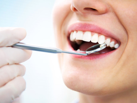 אישה אצל רופא שיניים (צילום: YanLev, Shutterstock)