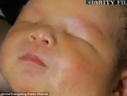 תינוק בלי עיניים (צילום: People's Daily Online)