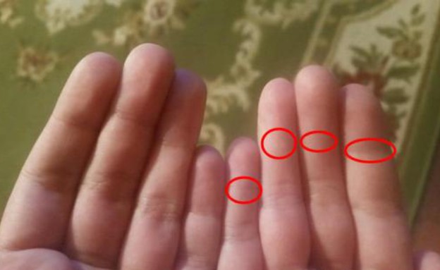 מה ההבדל בכפות הידיים (צילום: Reddit)