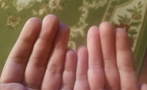 מה ההבדל בכפות הידיים (צילום: Reddit)