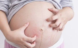 מתגרדת בהריון (צילום: Shutterstock)