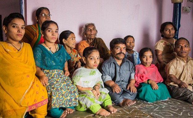 משפחת גמדים (צילום: Chandra Sena)