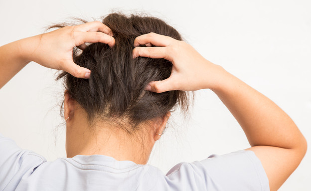אישה מגרדת בראש (צילום: Shutterstock)