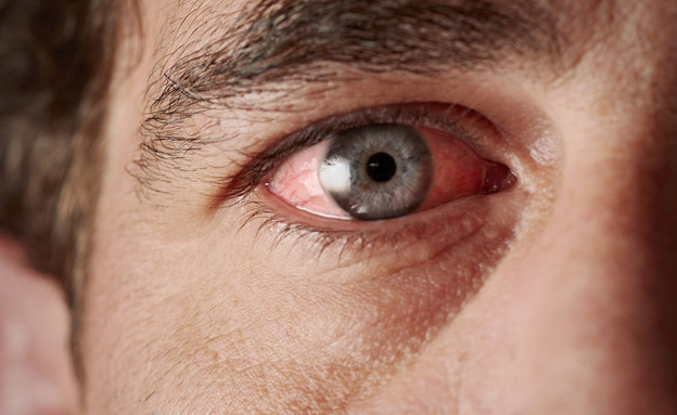 עין אדומה (צילום: aastock, Shutterstock)