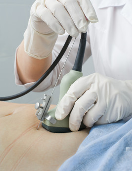 בדיקת דם במקום בדיקת מי השפיר (צילום: Shutterstock) בדיקת דם במקום בדיקת מי השפיר (צילום: Shutterstock)