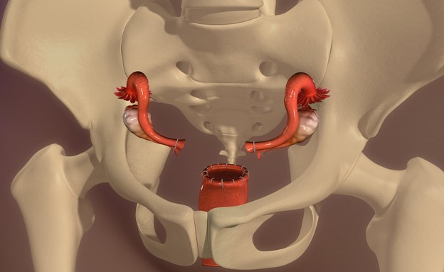 כריתת רחם - אילוסטרציה (צילום: sciencepics, Shutterstock)