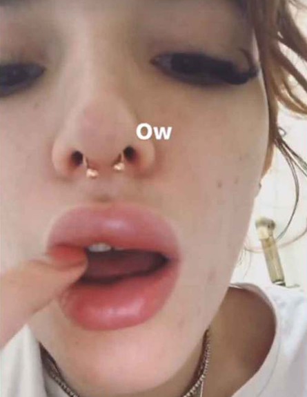 השפתיים של בלה ת'ורן (צילום: מתוך instagram)