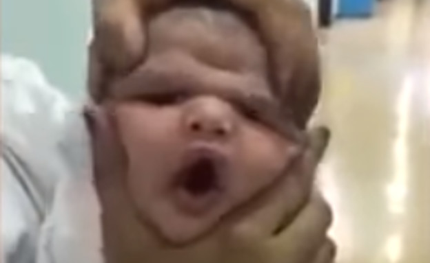 תינוק נמעך (צילום: צילום מתוך יוטיוב)