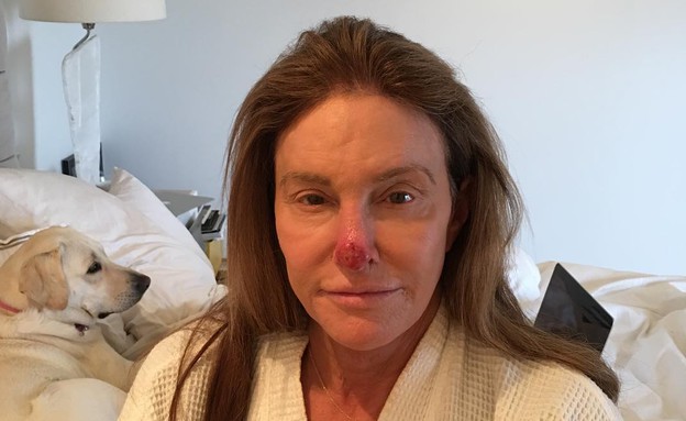 קייטלין ג'נר עוברת ניתוח, מרץ 2018 (צילום: מתוך instagram, צילום מסך)