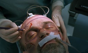 ניתוח מוח (צילום: Youtube/Fandango)