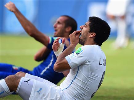 אחרי הנשיכה. רוצה לכפר על מה שקרה (Getty) אחרי הנשיכה. רוצה לכפר על מה שקרה (Getty)
