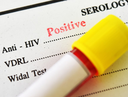 נשא HIV (צילום: Shutterstock)
