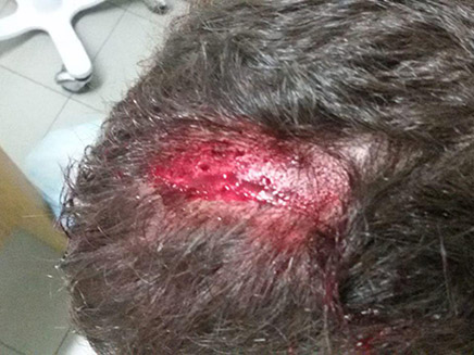 צעיר נפצע בראשו במהלך הקטטה (צילום: ארגון חוננו, חדשות)