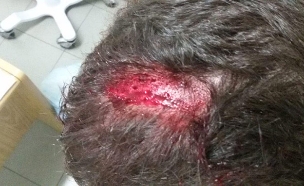 צעיר נפצע בראשו במהלך הקטטה (צילום: ארגון חוננו, חדשות)