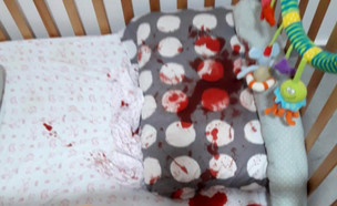 תינוקת בת שנה ננשכה על ידי חולדה במיטתה (צילום: מתוך "חדשות הבוקר" , קשת12)