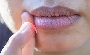 יובש בשפתיים (צילום: Werayuth Tes, shuttetstock)