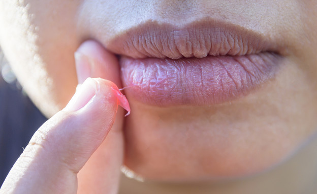 Dry or chapped lips: How can this phenomenon be alleviated?