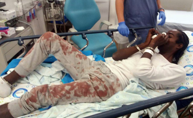 הצעיר לאחר שנפצע בתחנת המשטרה (צילום: חדשות)