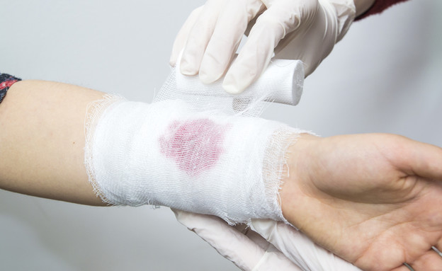 Everything that is important to know about wounds and difficulties in healing