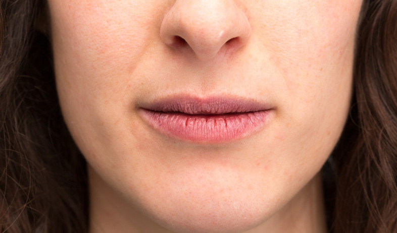 שפתיים יבשות (צילום:  sruilk, shutterstock)