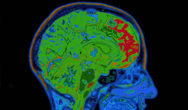 מוח (צילום: SpeedKingz, Shutterstock)