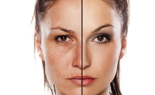 לפני ואחרי צעירה יותר אישה (צילום: shutterstock: VladimirGjorgiev)