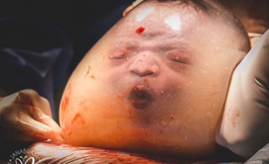 תינוק שנולד בשק ההריון (צילום: Janaina Oliveira, מתוך instagram)