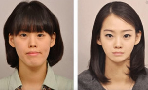 ניתוח קוריאני לפני ואחרי (צילום: youtube)