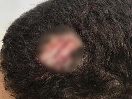 פציעת הילד בבית הספר