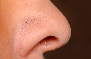שחורים על האף (צילום:  Nau Nau, shutterstock)