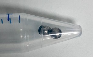 כדוריות מגנט שהוצאו מבטנה של ירדן כהן (צילום: באדיבות המרכז הרפואי מאיר)