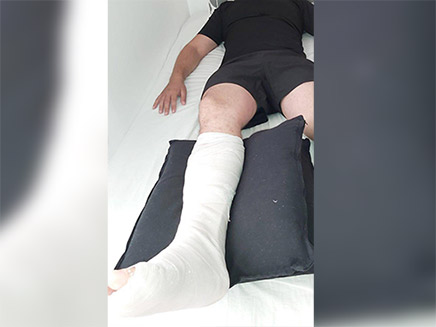 רגלו של השוטר שנשברה בתקרית (צילום: משטרת ישראל, חדשות)