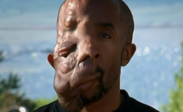 תסמונת פנים (צילום: יוטיוב\Barcroft TV)