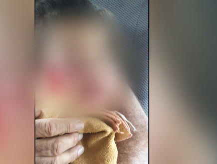 התינוק שהותקף על ידי טיגריס בתאילנד (צילום: באדיבות המשפחה, החדשות)