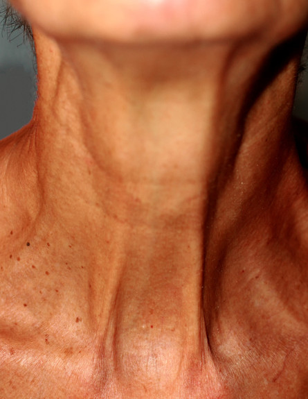צוואר של אישה מבוגרת (צילום: Timonina, shutterstock)