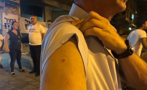 פעיל שנפצע קל מירי ברובה אוויר בכנס כחול-לבן ברחובות