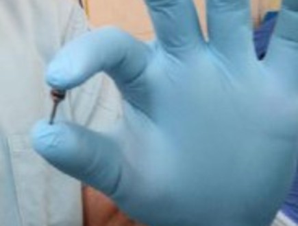 הרופאים נדהמו: מברג של רופא שיניים התגלה בגופה של  (צילום: המרכז הרפואי זיו)